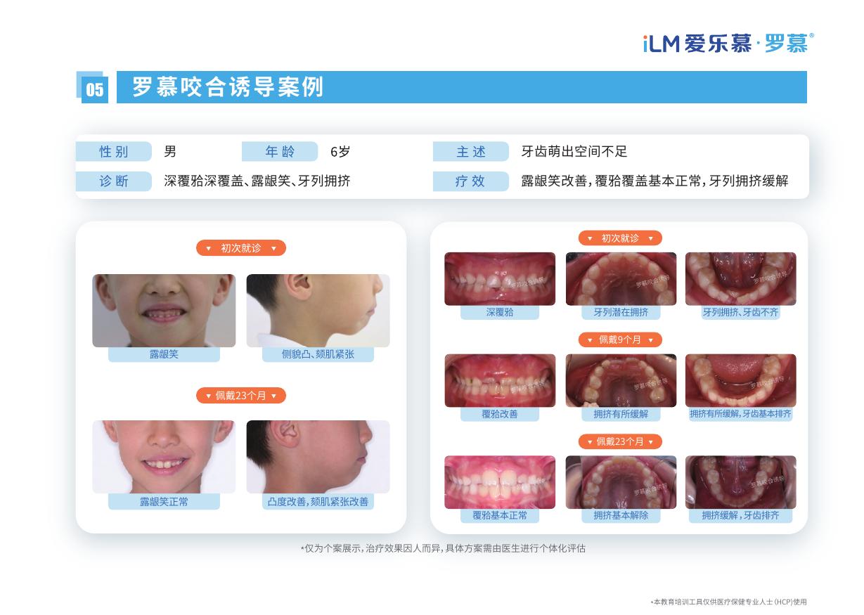 腾讯文档图片